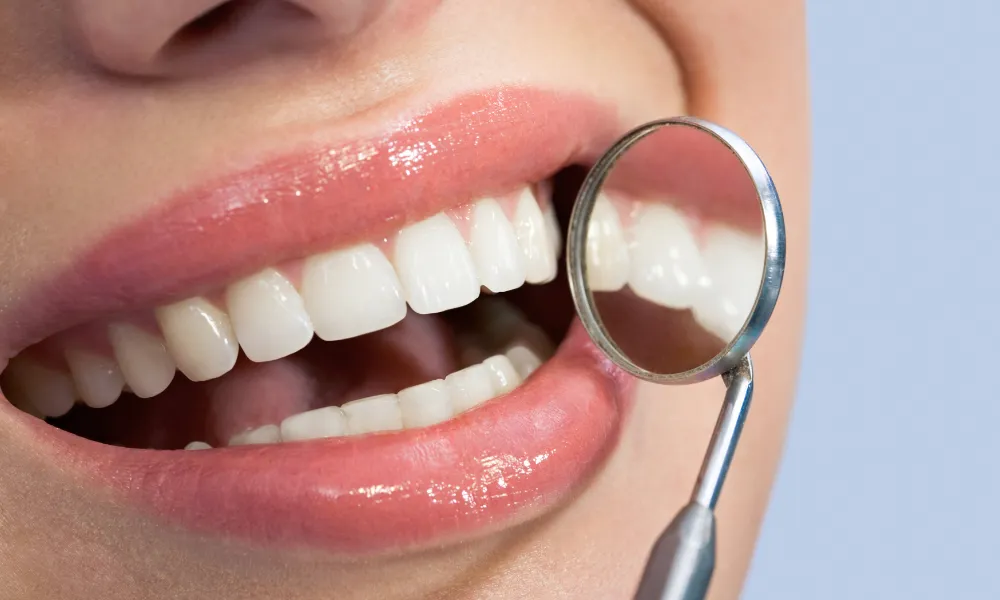 cap dental teeth cleaning