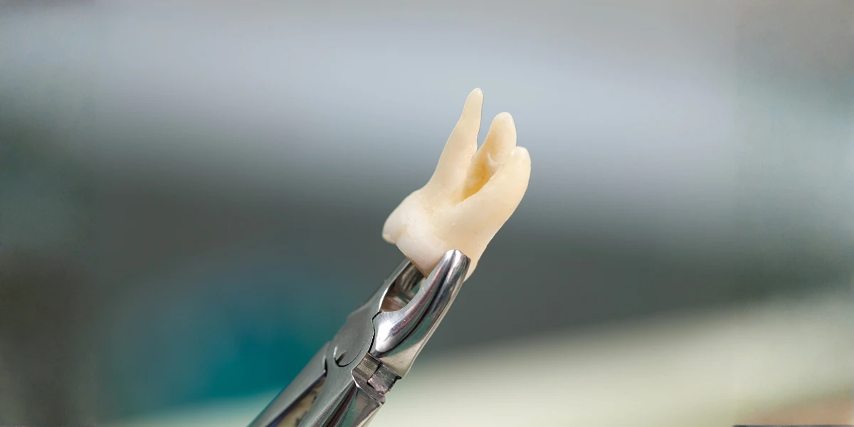 tooth extraction cap dental