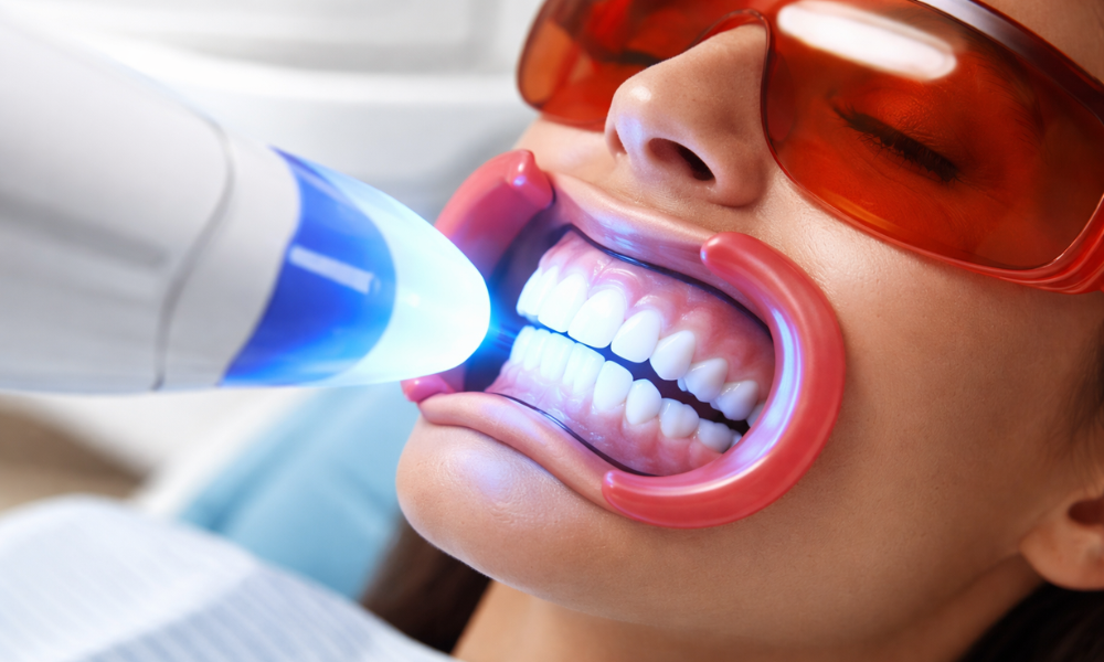 woman receiving professional teeth whitening treatment Boynton Beach FL
