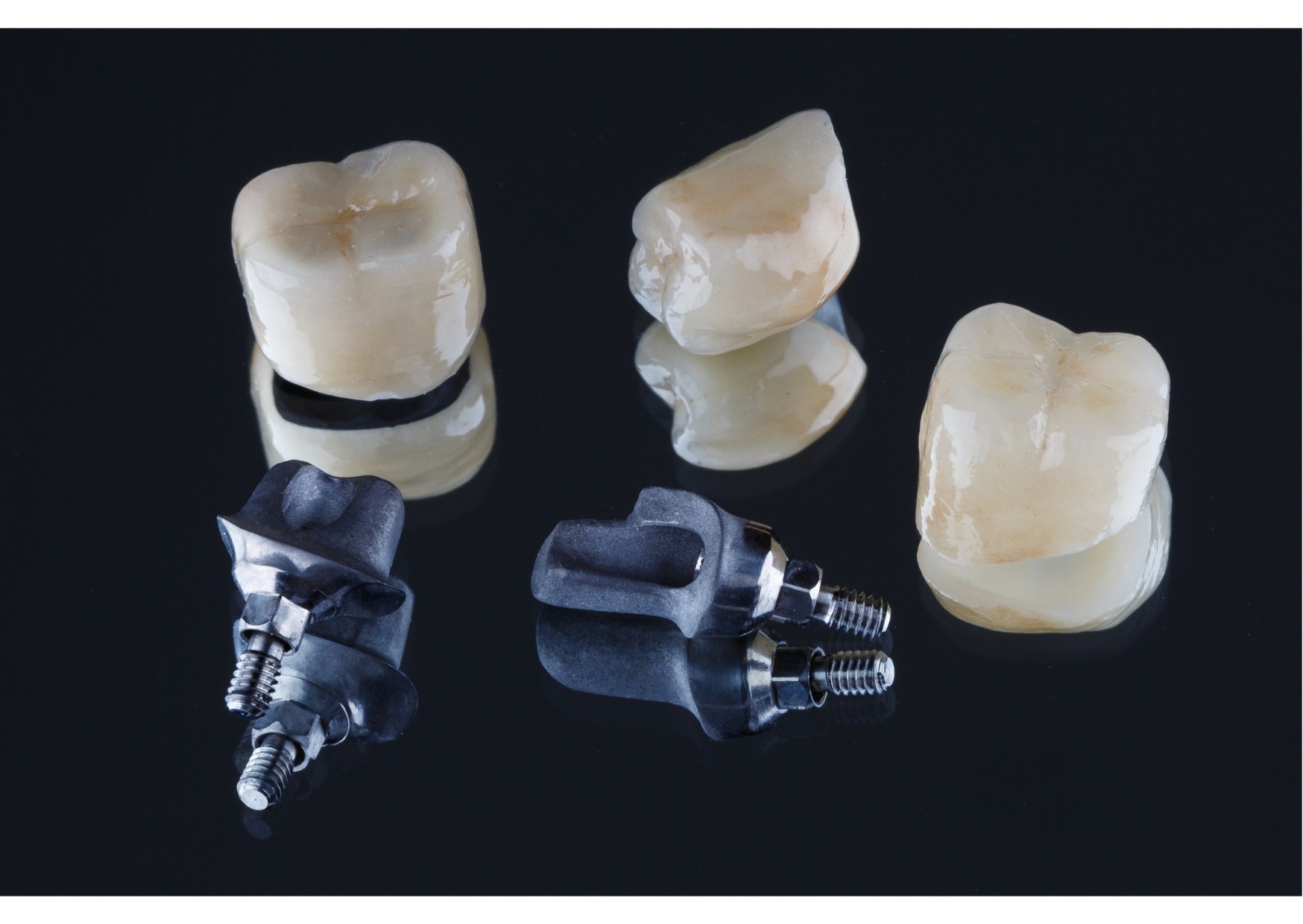 Dental implant components with crowns and titanium posts displayed on black background.
