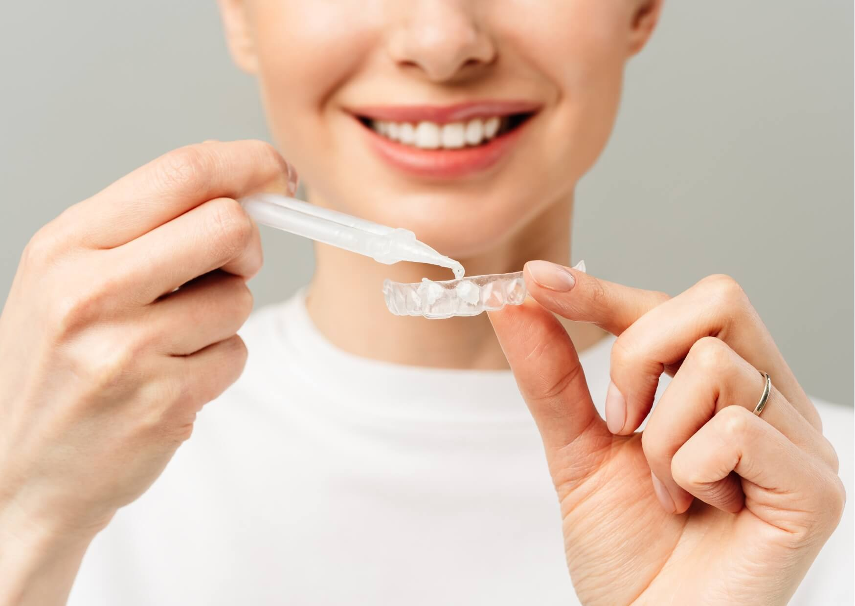 Person applying whitening gel to a custom tray, demonstrating an at-home teeth whitening option recommended by a dentist.