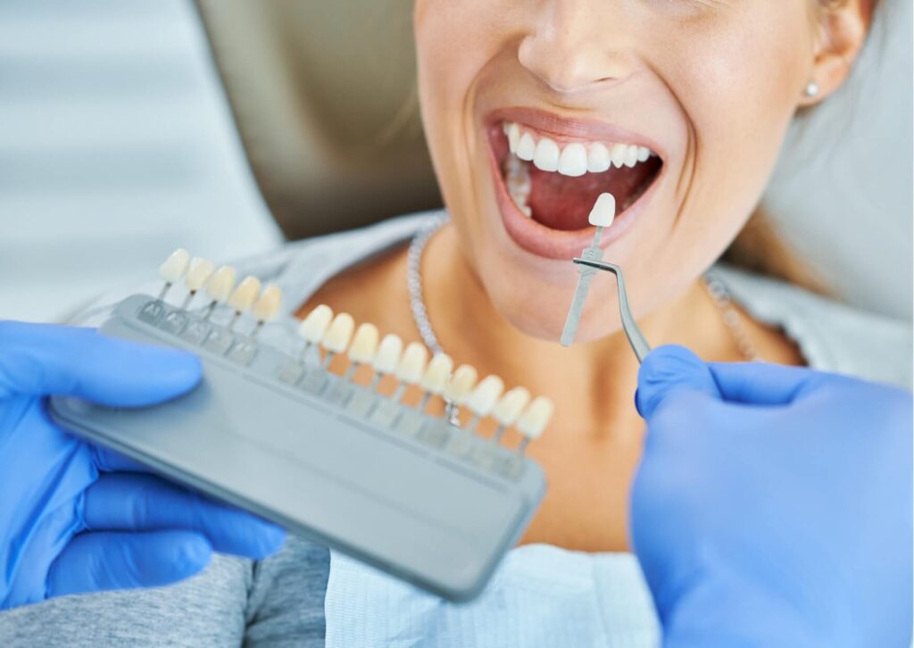 Dentist using a shade guide to compare tooth color before professional teeth whitening treatment and discuss whitening options.